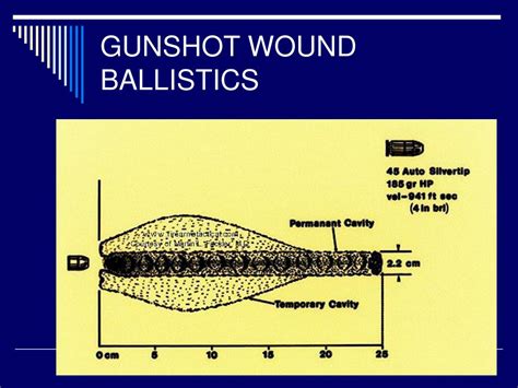 odd and even rule in gunshot wounds|Gunshot Wounds: Ballistics, Pathology, and Treatment .